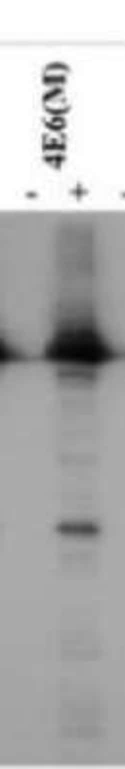 SARS RDRP Antibody (4E6) - BSA Free, Novus Biologicals 0.025 mL, Unconjugated:Antibodies,