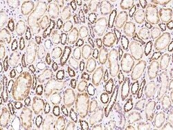 SARS2 Antibody, Novus Biologicals 100 &mu;g, Unconjugated:Antibodies, Polyclonal