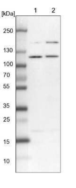 SART1 Antibody, Novus Biologicals:Antibodies:Primary Antibodies