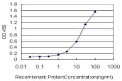 SART2 Antibody (6D4), Novus Biologicals 0.1 mg | Buy Online | Novus Biologicals | Fisher Scientific