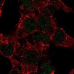 SART3 Rabbit anti-Human, Polyclonal, Novus Biologicals 100 &mu;g | Buy Online | Novus Biologicals | Fisher Scientific