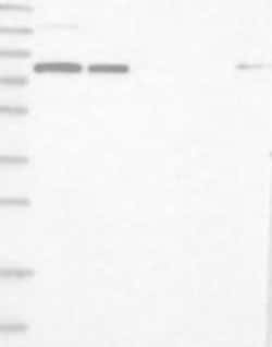 SART3 Rabbit anti-Human, Polyclonal, Novus Biologicals 100 &mu;g | Buy Online | Novus Biologicals | Fisher Scientific