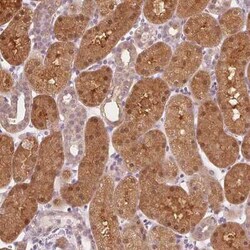 SAT2 Antibody, Novus Biologicals:Antibodies:Primary Antibodies