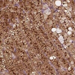 SAT2 Antibody, Novus Biologicals 25 &mu;L | Buy Online | Novus Biologicals | Fisher Scientific