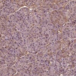 SAT2 Antibody, Novus Biologicals 25 &mu;L | Buy Online | Novus Biologicals | Fisher Scientific