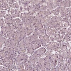 SAT2 Antibody, Novus Biologicals:Antibodies:Primary Antibodies
