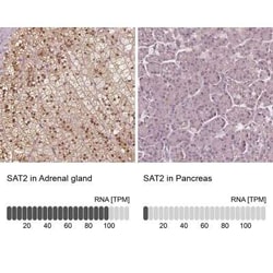 SAT2 Antibody, Novus Biologicals:Antibodies:Primary Antibodies