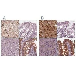SAT2 Antibody, Novus Biologicals:Antibodies:Primary Antibodies