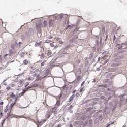 SAT2 Antibody, Novus Biologicals:Antibodies:Primary Antibodies