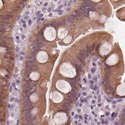 SAT2 Antibody, Novus Biologicals:Antibodies:Primary Antibodies