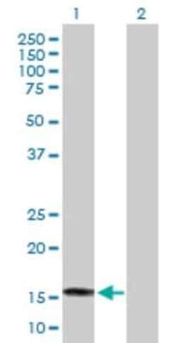 SAT2 Antibody, Novus Biologicals 0.05 mg; Unconjugated:Anticorps, Polyclonal