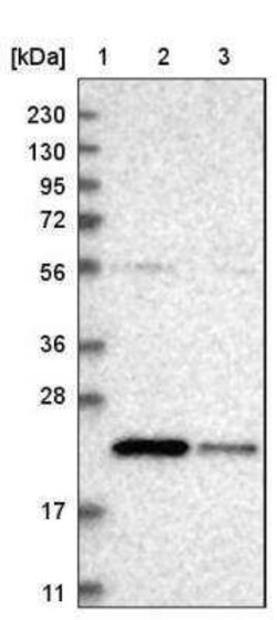 SAT2 Antibody, Novus Biologicals 25 &mu;L | Buy Online | Novus Biologicals | Fisher Scientific