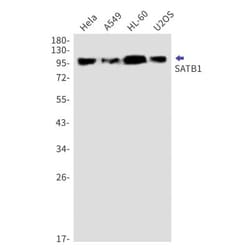 SATB1 Antibody (S03-5H7), Novus Biologicals:Antibodies:Primary Antibodies