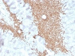SATB2 Antibody (SATB2/4374R) - Azide and BSA Free, Novus Biologicals 100