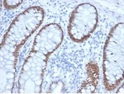 SATB2 Mouse anti-Human, Clone: rSATB2/6929, Novus Biologicals 100 &mu;g;