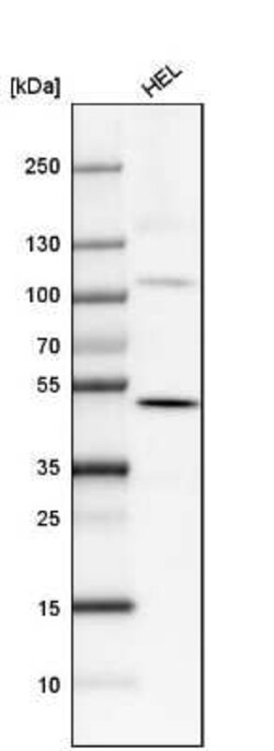 SATB2 Antibody (CL0276), Novus Biologicals 25 &mu;L, Unconjugated:Antibodies,