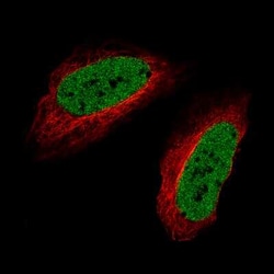 SATB2 Antibody (CL0323), Novus Biologicals:Antibodies:Primary Antibodies