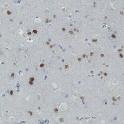 SATB2 Antibody (CL0323), Novus Biologicals 25 &mu;L, Unconjugated:Antibodies,