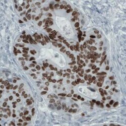 SATB2 Antibody (CL0323), Novus Biologicals 25 &mu;L, Unconjugated:Antibodies,