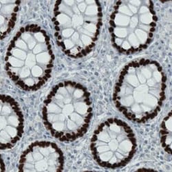 SATB2 Antibody (CL0323), Novus Biologicals 25 &mu;L, Unconjugated:Antibodies,