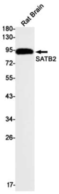 SATB2 Antibody (S02-1H5), Novus Biologicals 50 &mu;g; Unconjugated:Antibodies,
