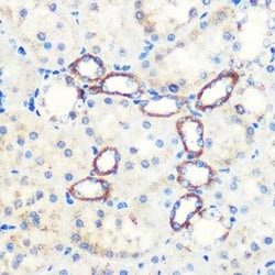 SAV1 Rabbit anti-Human, Mouse, Rat, Polyclonal, Novus Biologicals:Antibodies:Primary