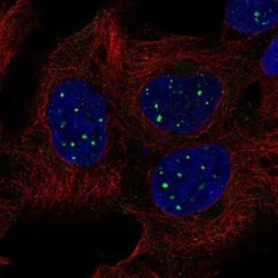 SBF1 Antibody, Novus Biologicals 25ul; Unconjugated:Antibodies, Polyclonal