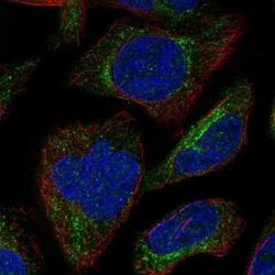 SBK3 Antibody, Novus Biologicals 25ul; Unconjugated:Antibodies, Polyclonal