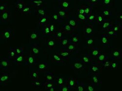SBNO1 Antibody, Novus Biologicals 50 &mu;g; Unconjugated:Anticuerpos