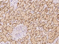 SBNO2 Antibody, Novus Biologicals:Antibodies:Primary Antibodies