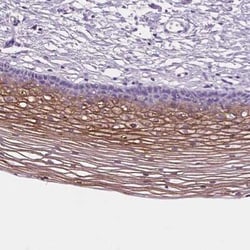 SBSN Antibody, Novus Biologicals:Antibodies:Primary Antibodies