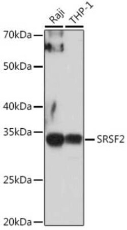 SC35 Antibody - Azide and BSA Free, Novus Biologicals 0.1 mL; Unconjugated:Antibodies,