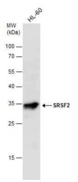 SC35 Antibody, Novus Biologicals 100 &mu;g | Buy Online | Novus Biologicals | Fisher Scientific