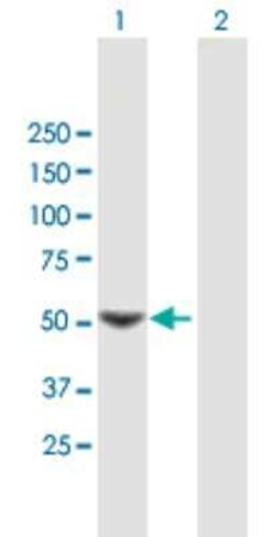 SC65 Antibody, Novus Biologicals 0.05 mg | Buy Online | Novus Biologicals | Fisher Scientific