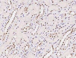 SCAF8/RBM16 Antibody, Novus Biologicals 100 &mu;g | Buy Online | Novus Biologicals | Fisher Scientific