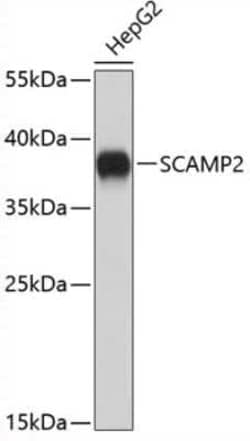 SCAMP2 Antibody - Azide and BSA Free, Novus Biologicals:Antibodies:Primary