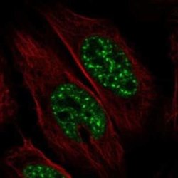 SCAND1 Rabbit anti-Human, Polyclonal, Novus Biologicals 25 &mu;g | Buy Online | Novus Biologicals | Fisher Scientific