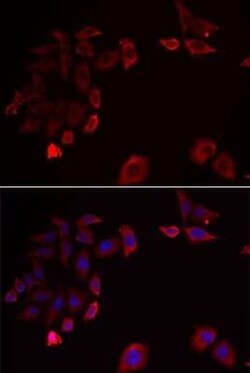 SCAP2 Antibody - BSA Free, Novus Biologicals 0.02 mL; Unconjugated:Antibodies,