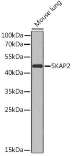SCAP2 Antibody - BSA Free, Novus Biologicals 0.1 mL; Unconjugated:Antibodies,