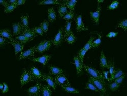 SCCPDH Antibody, Novus Biologicals 100 &mu;g, Unconjugated:Antibodies,