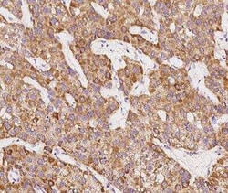 SCCPDH Antibody, Novus Biologicals 100 &mu;g, Unconjugated:Antibodies,
