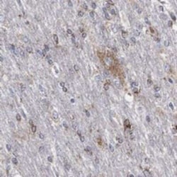 SCCPDH Rabbit anti-Human, Polyclonal, Novus Biologicals 25 &mu;g; Unconjugated:Antibodies,