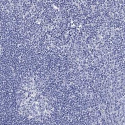 SCCPDH Rabbit anti-Human, Polyclonal, Novus Biologicals 25 &mu;g; Unconjugated:Antibodies,