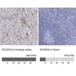 SCCPDH Rabbit anti-Human, Polyclonal, Novus Biologicals 25 &mu;g; Unconjugated:Antibodies,