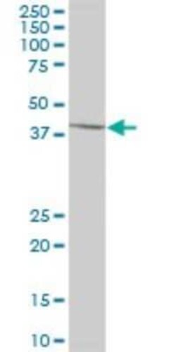 SCCPDH Antibody, Novus Biologicals 0.05 mg | Buy Online | Novus Biologicals | Fisher Scientific