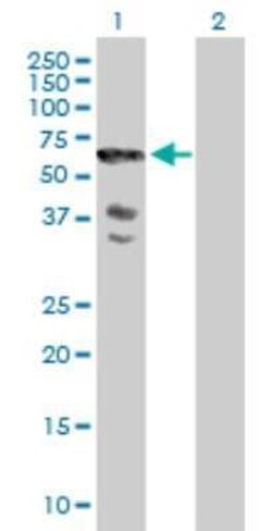 SCHIP1 Antibody, Novus Biologicals 0.05 mg | Buy Online | Novus Biologicals | Fisher Scientific