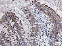SCIN Antibody (S07-6G2), Novus Biologicals 50 &mu;g; Unconjugated:Antibodies,