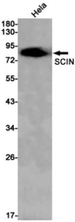 SCIN Antibody (S07-6G2), Novus Biologicals 50 &mu;g; Unconjugated:Antibodies,