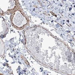 SCLT1 Antibody, Novus Biologicals:Antibodies:Primary Antibodies