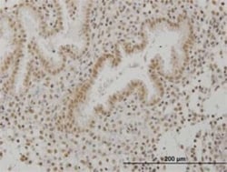 SCML1 Antibody (4G3), Novus Biologicals 0.1 mg | Buy Online | Novus Biologicals | Fisher Scientific